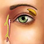 Nasolacrimal & Orbit - Gold Coast Eye & Oculoplastic Surgeons